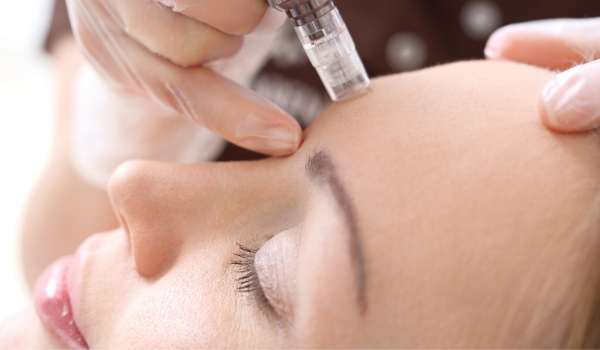 microneedling aftercare