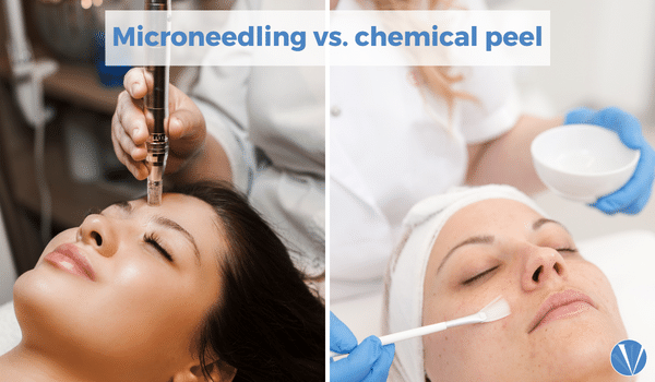 microneedling vs chemical peel