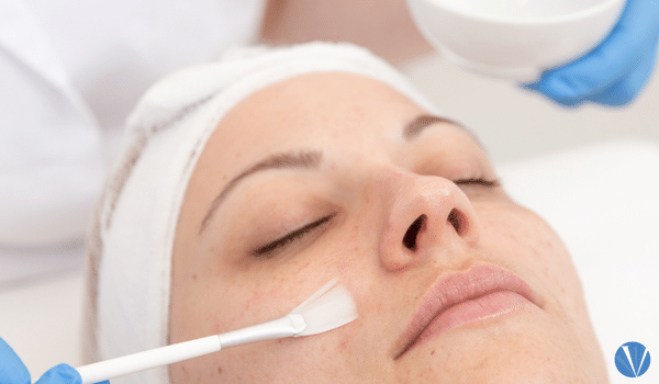 chemical peel aftercare guide