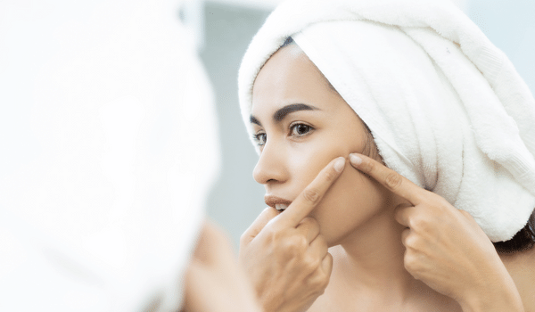 ultimate guide to treating mild acne for all ages - vujevich dermatology blog
