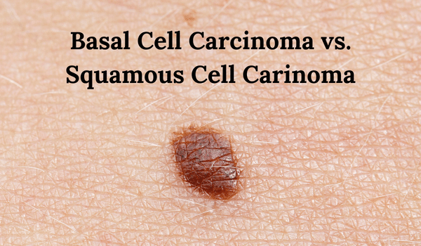 Basal Cell Carcinoma vs Squamous Cell Carcinoma | Vujevich Dermatology
