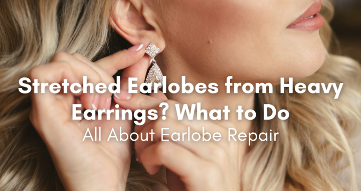 stretched earlobes from heavy earrings