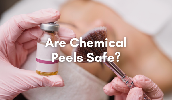 are chemical peels safe