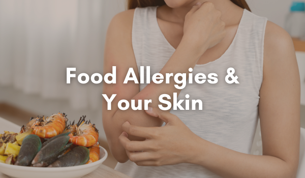 food allergies and your skin